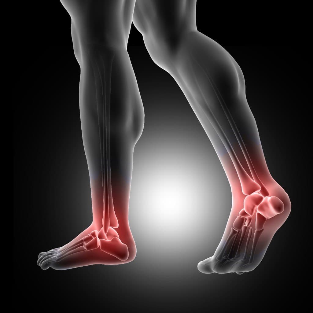 Ankle pain highlight