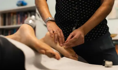 Dry Needling