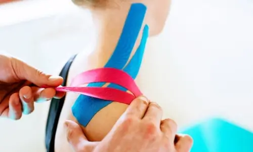Taping treatments